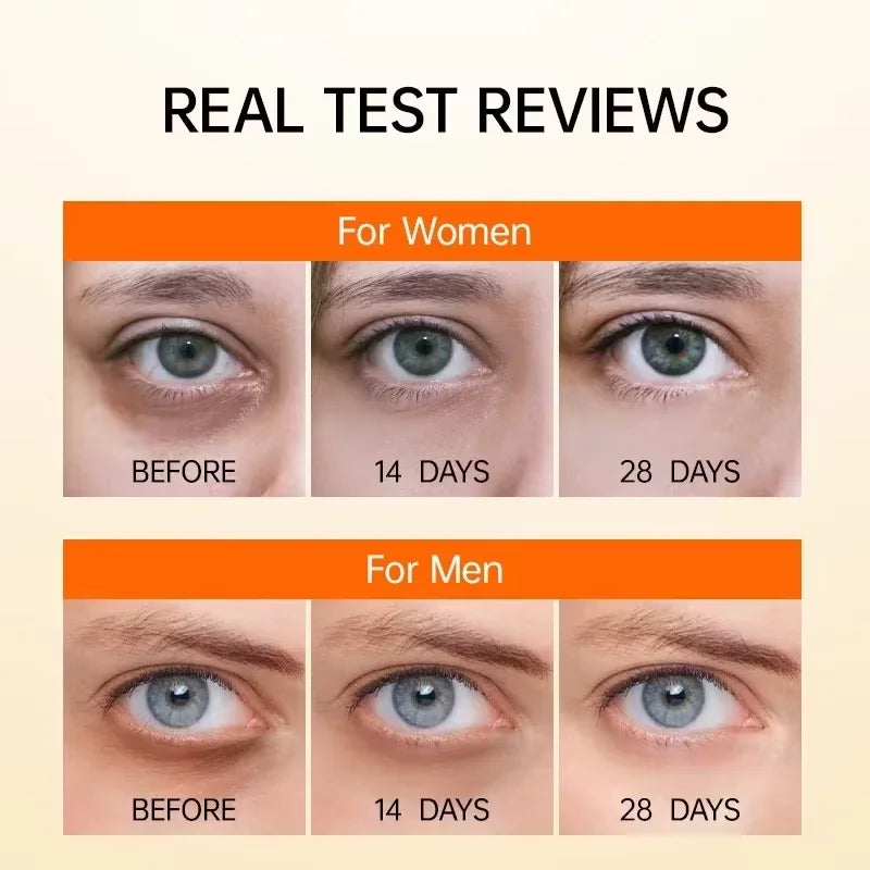 Anti Dark Circle Eye Serum Oil Retinol anti Wrinkle Firming Skin Remove Eye Bag Fade Fine Line Whitening Brighten Eye Care Korea