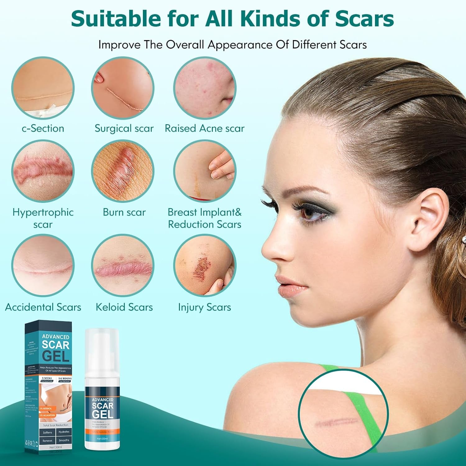 Scar Gel, Scar Cream, Advance Scar Gel for Surgical Scars,Face,Body,Leg, Burns, Acene,C-Section, Stretch Marks, Keloids for Old & New Scars,Scar Removal for Women Men,1.76Oz