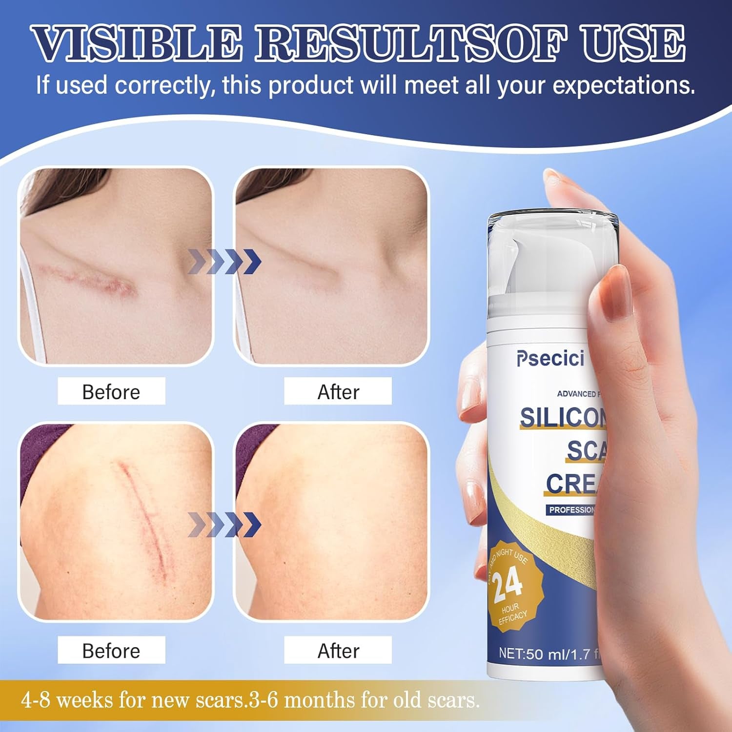 Scar Cream,Advanced Scar Gel,Silicone Scar Gel,Scar Removal Cream for Surgical Scars,Burn,Acne,Stretch Mark,Keloid Bump,C Section Scars 1.7 Oz(50G), Blue